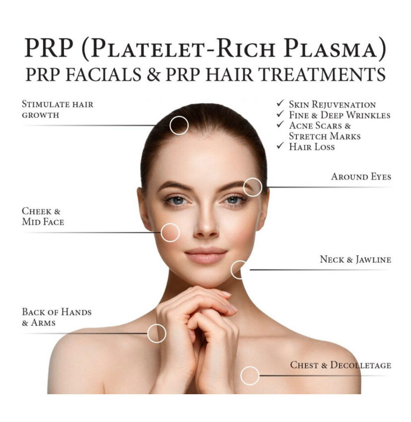 PRP-Facial-Treatment